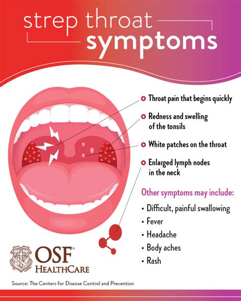 <b>Strep throat</b> is a bacterial infection with a number of classic signs and symptoms, such as: Sore <b>throat</b> Swelling in the back of the <b>throat</b> Enlarged tonsils Bad breath Fever Chills Headaches Decreased appetite All of these can occur with bacterial or viral infections, so the signs and symptoms alone cannot be used to diagnose <b>strep throat</b>. . Strep throat brain fog